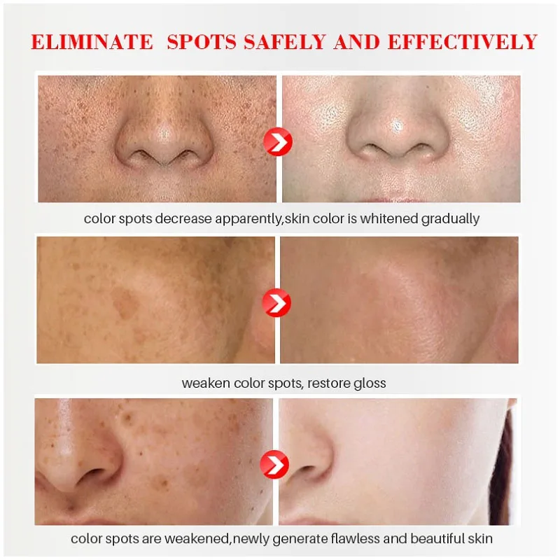 Effectieve Whitening Sproeten  - Licorice Root Sticks recensie en prijs