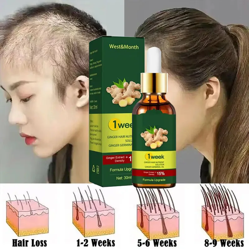 7 Dagen Gember Haargroeiproduc - Licorice Root Sticks recensie en prijs
